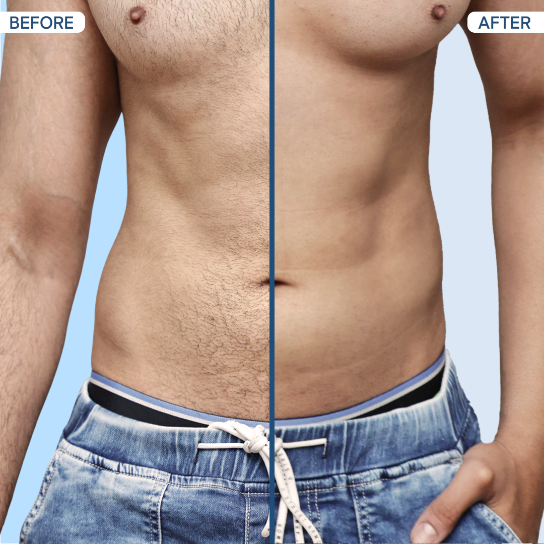 Before After Nut Groomer 1.O