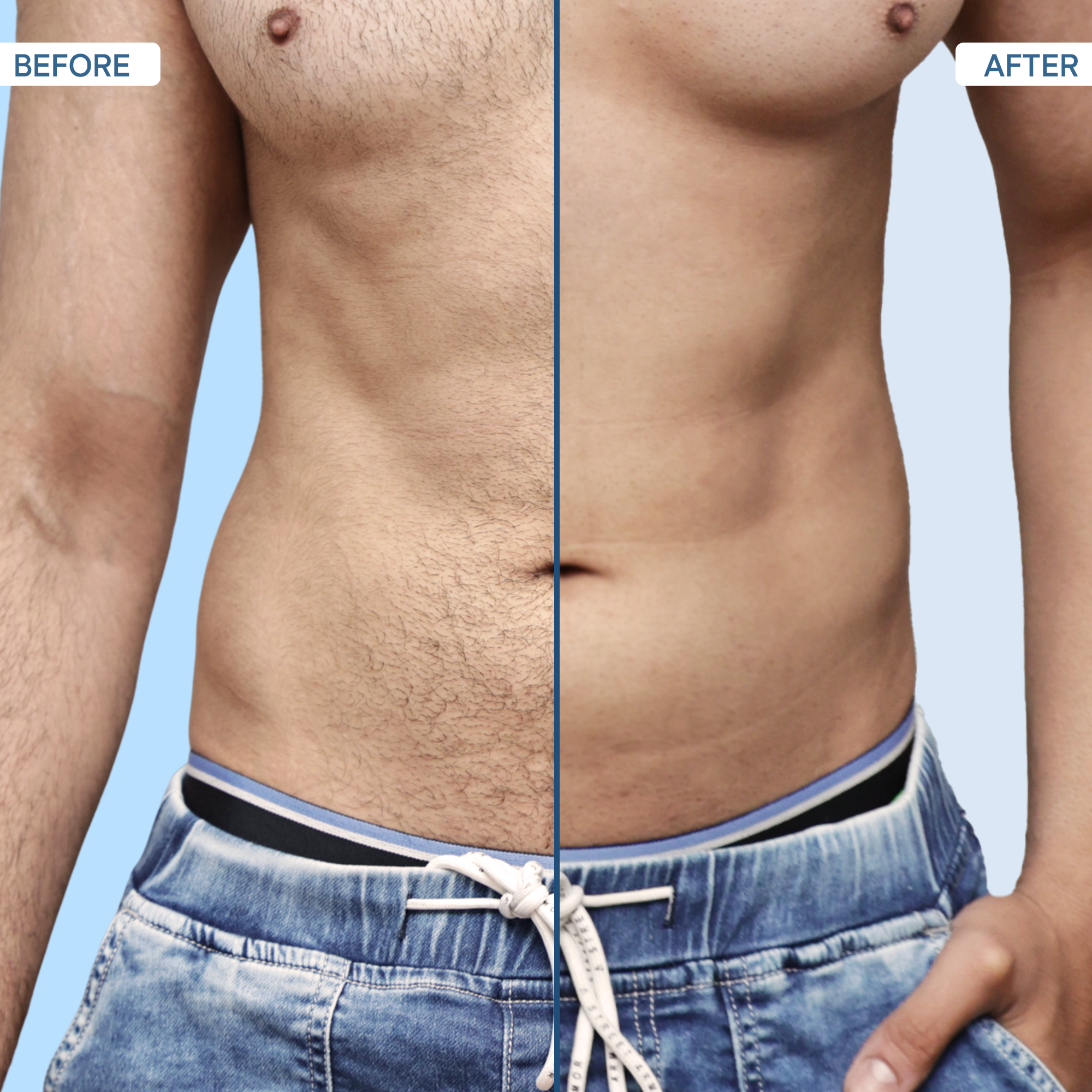 After Before Using Nut Groomer 2.0